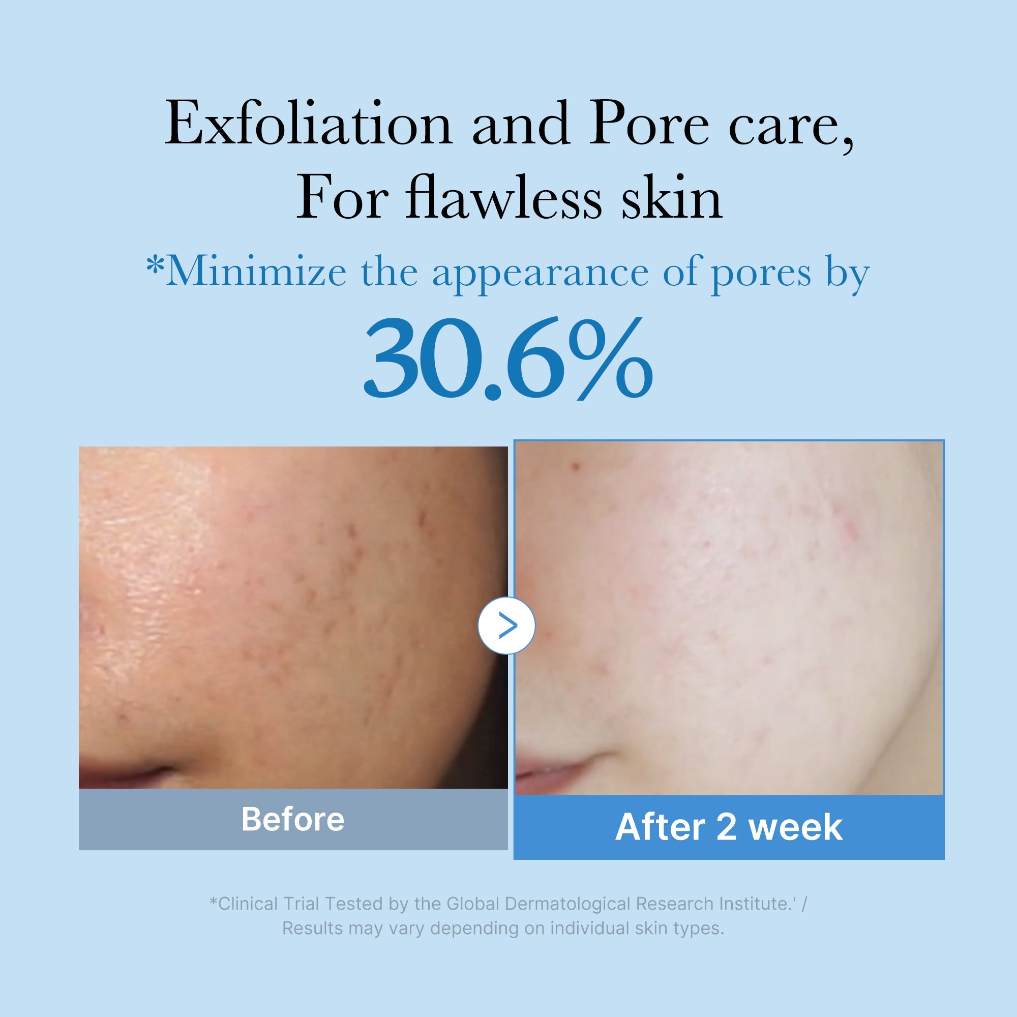 Zero Pore Toner V5