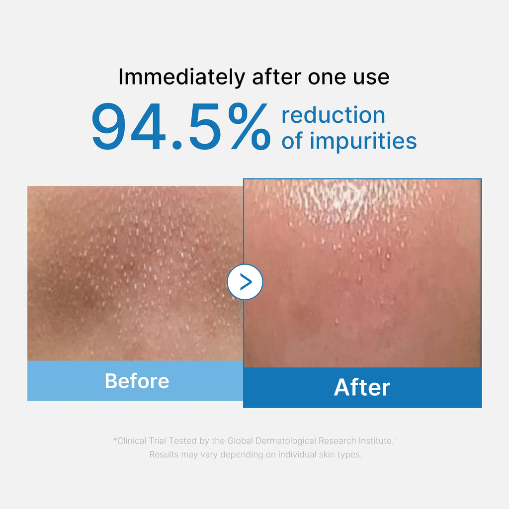 Zero Pore Blackhead Deep Cleansing Oil H8