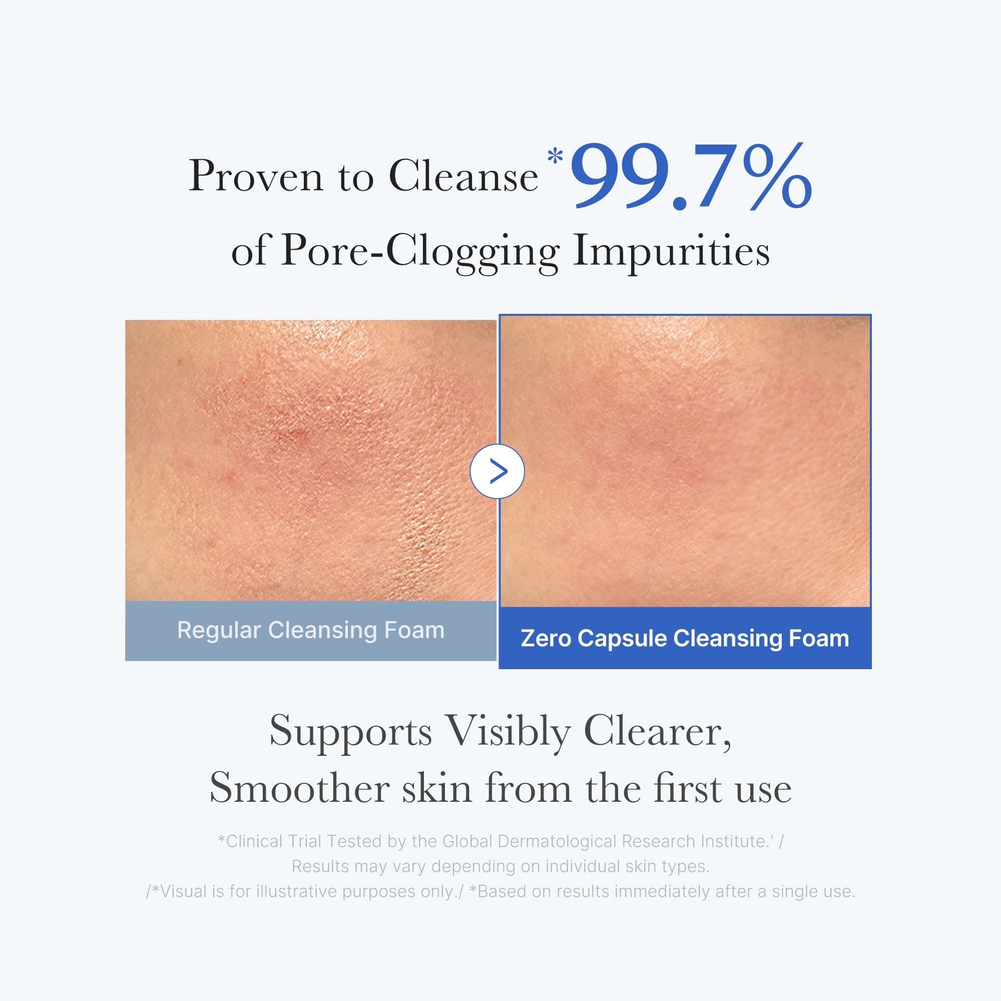 Zero Pore Capsule Cleansing Foam E4