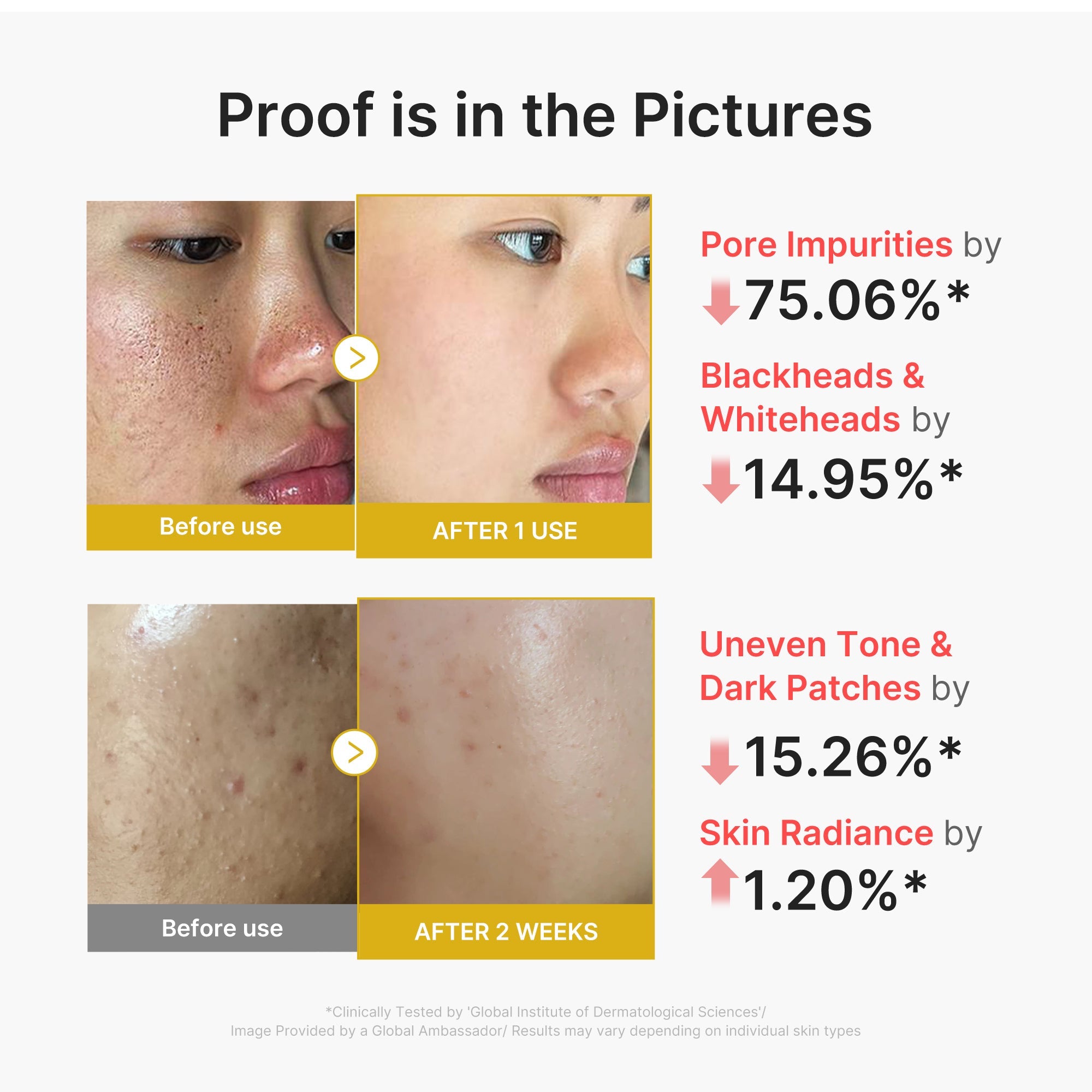 Kojic Acid Turmeric Peel Shot H7