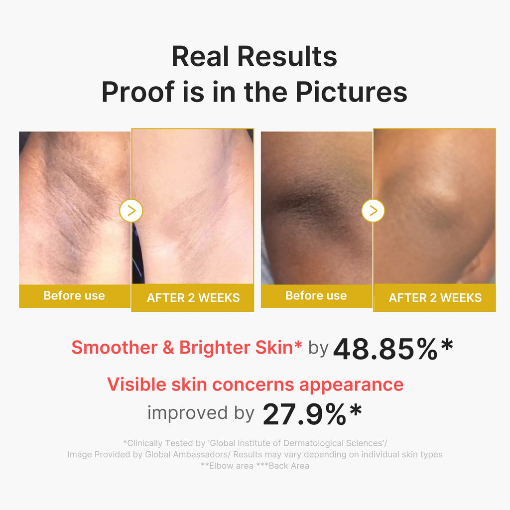 Kojic Acid Turmeric Body Peel Shot G7