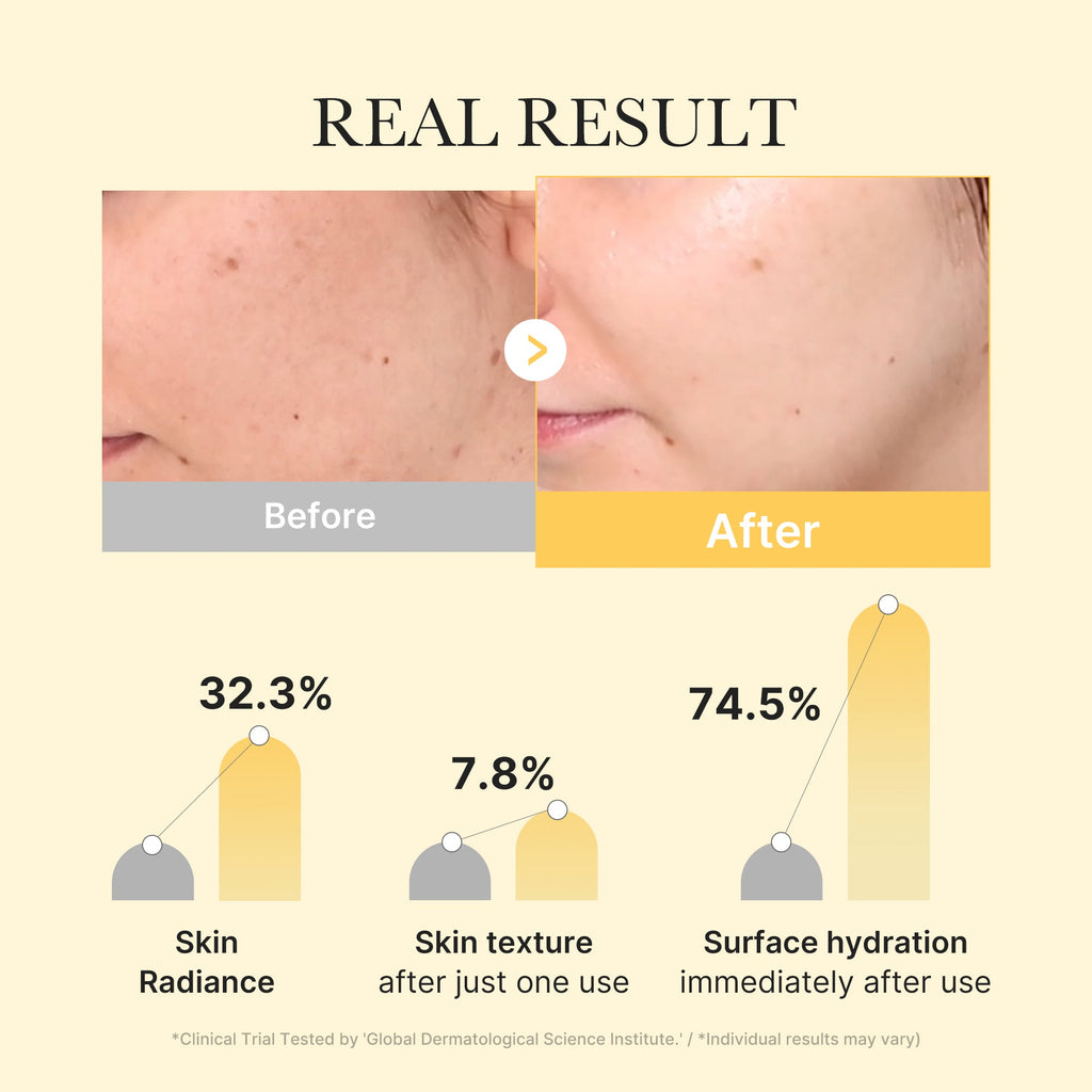 Kojic Acid Turmeric Gold Jelly Gel Mask O9