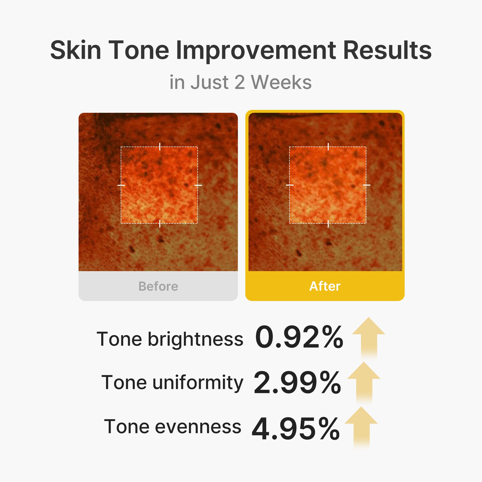 Kojic Acid Turmeric Vita Capsule Cream Q5