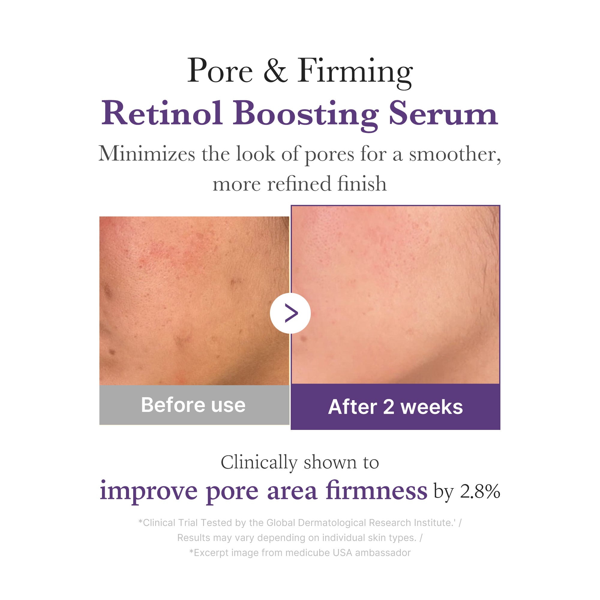 Retinol NMN Boosting Serum E2