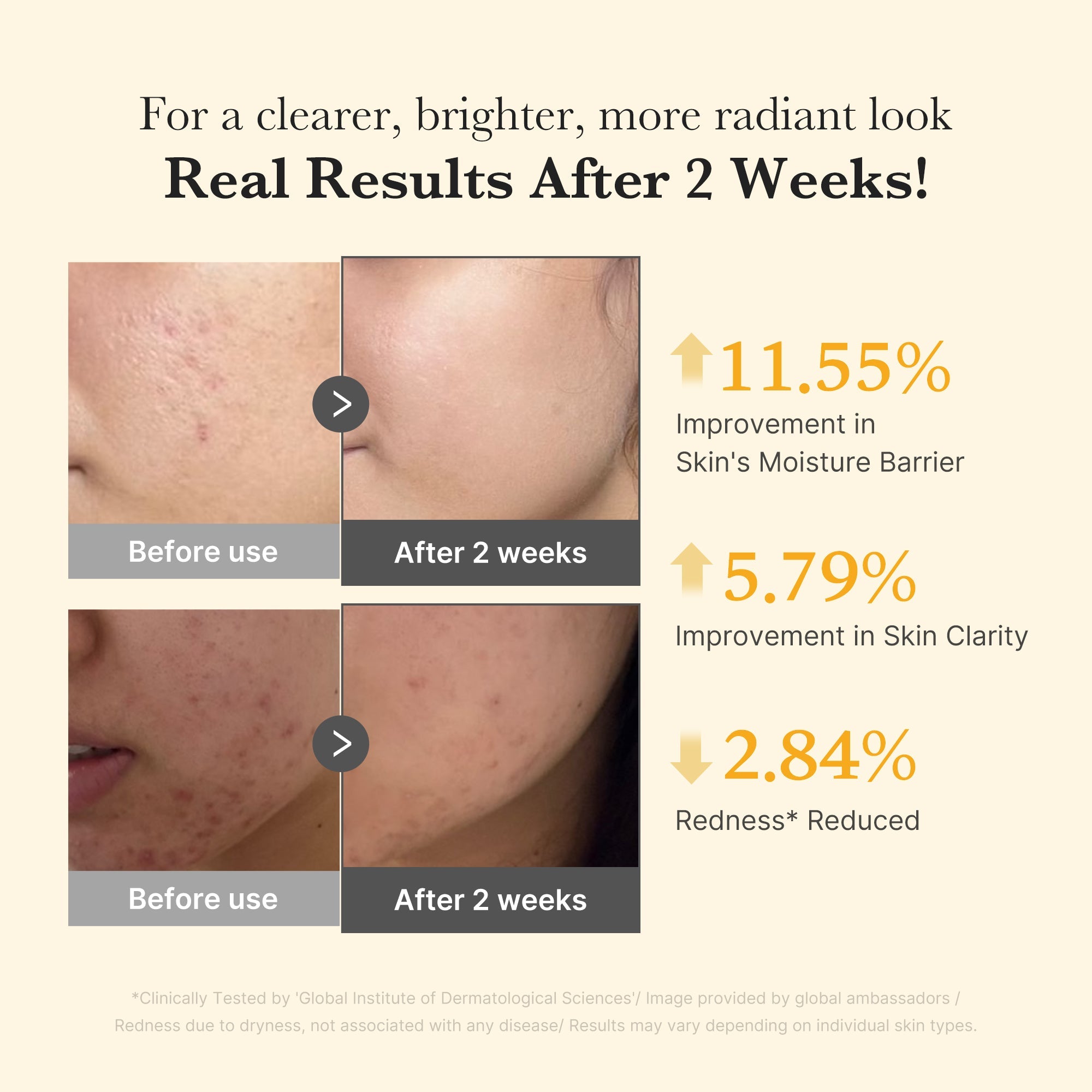Kojic Acid Turmeric Capsule Serum Z4