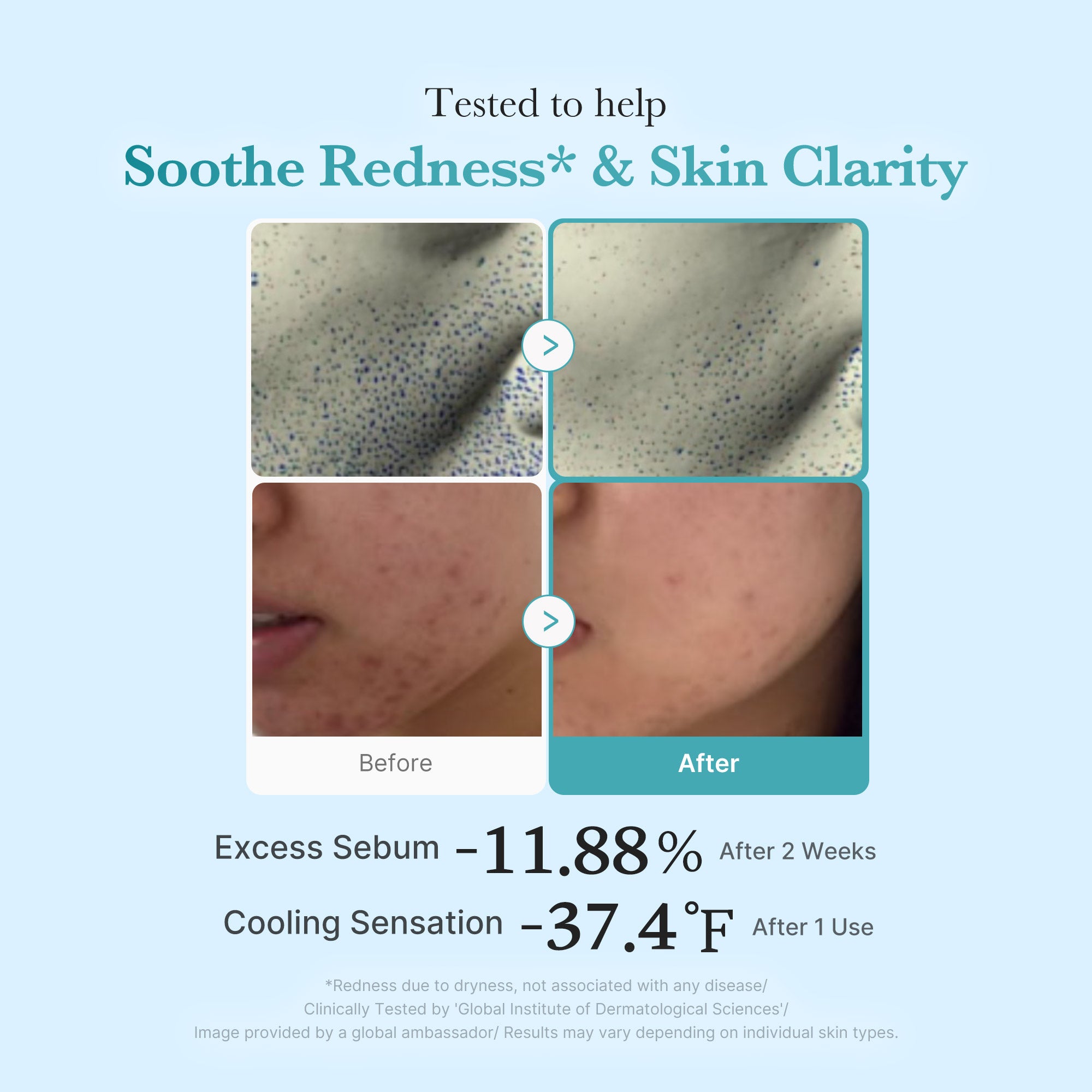 Azelaic Acid Niacinamide Clarifying Toner S7