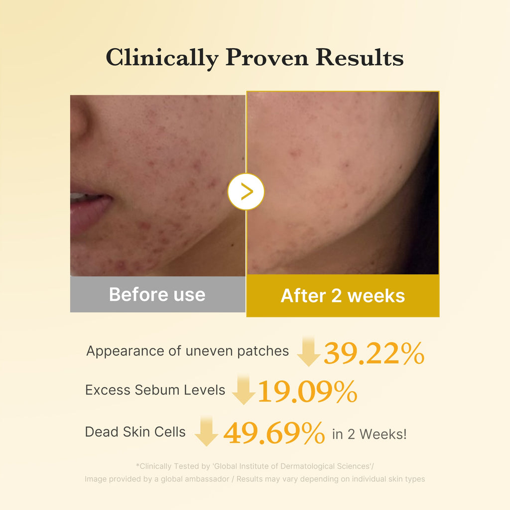 Kojic Acid Tumeric Toner Pad Z1