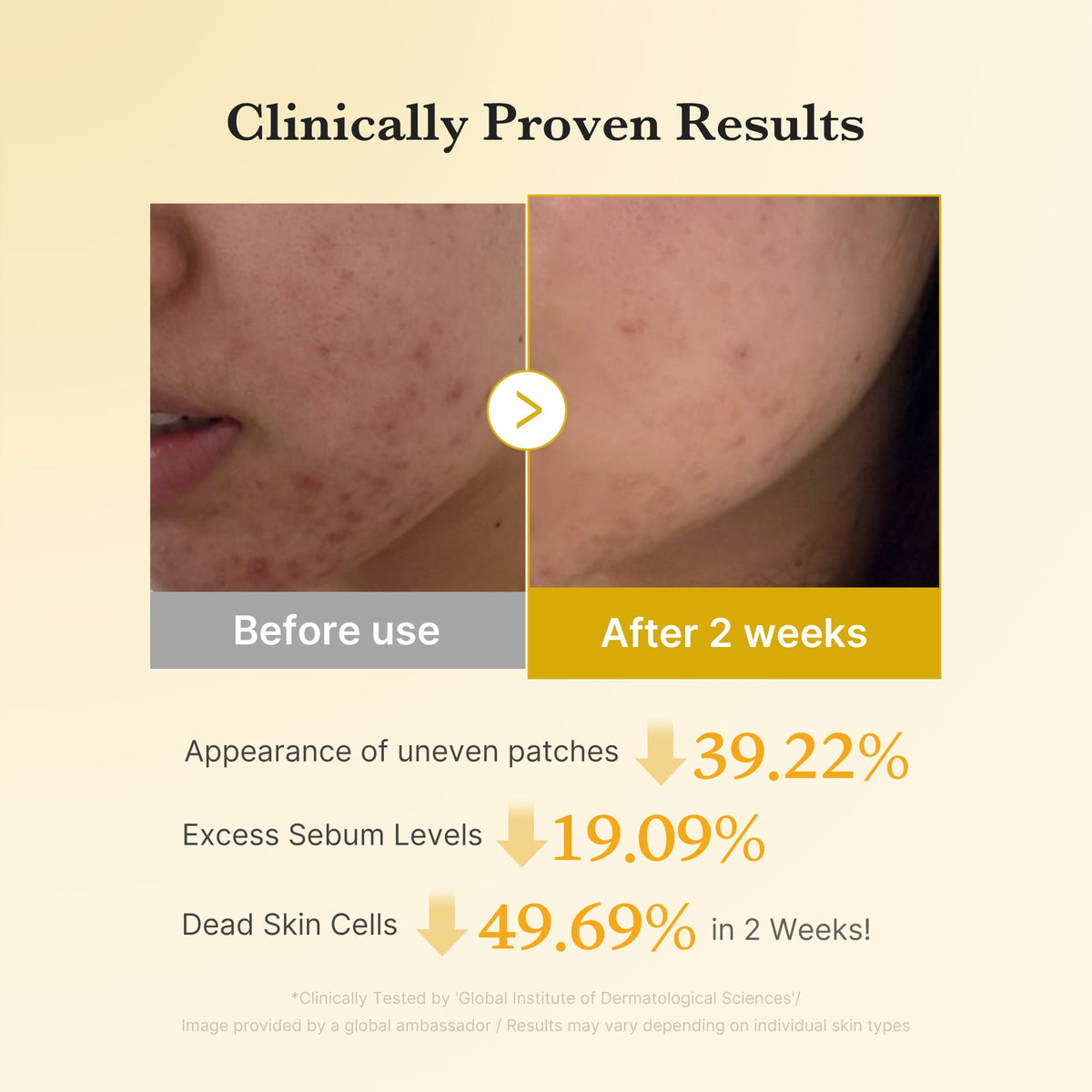 Kojic Acid Tumeric Toner Pad Z1