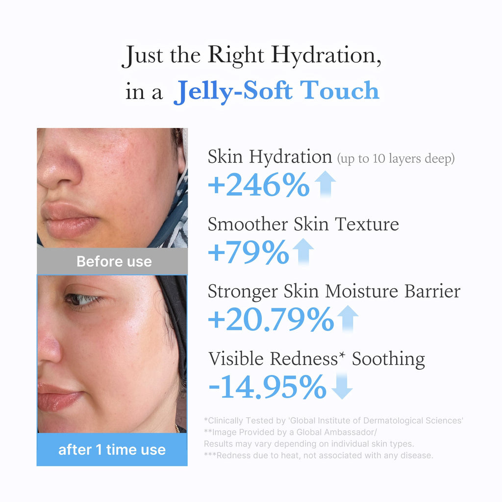 Hyaluronic Ceramide Moisturizing Jelly Cream R5