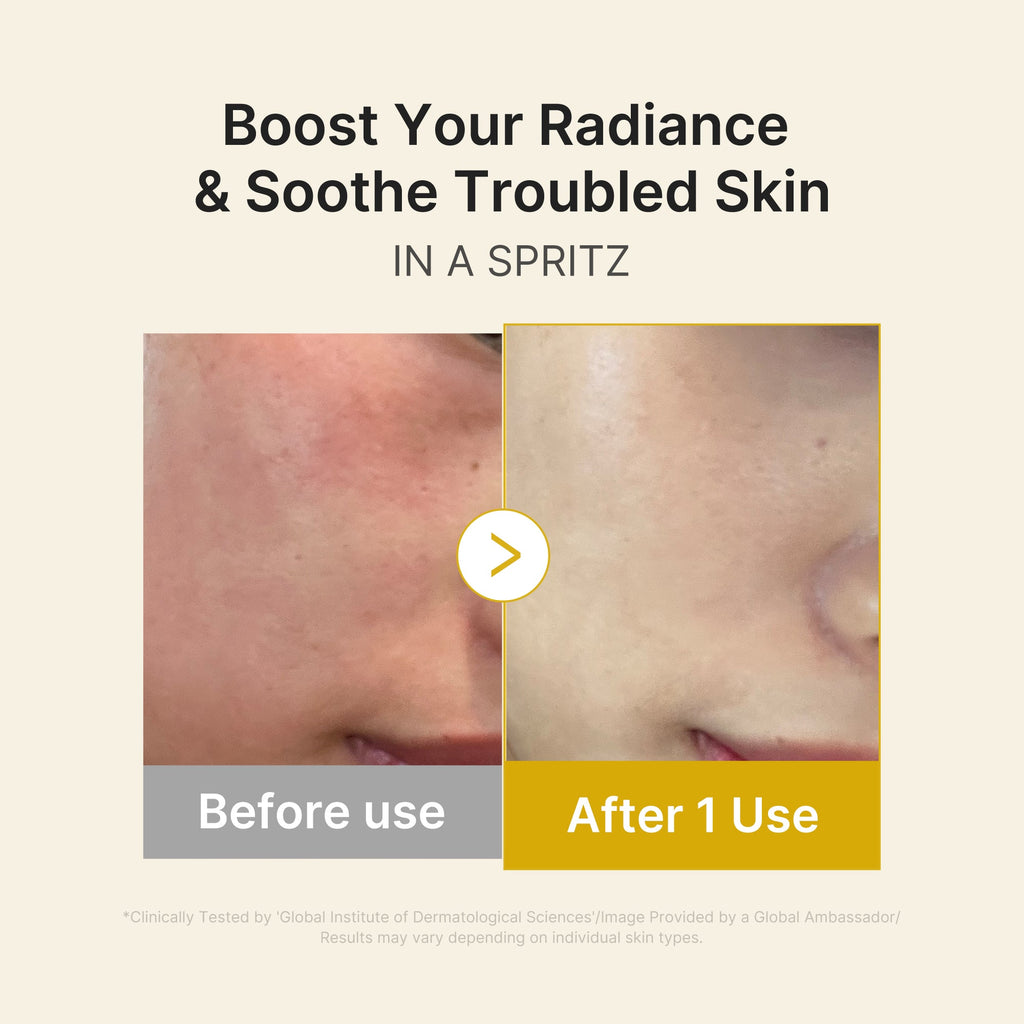 Kojic Acid Turmeric Vitamin Gold Jelly Mist Serum H1
