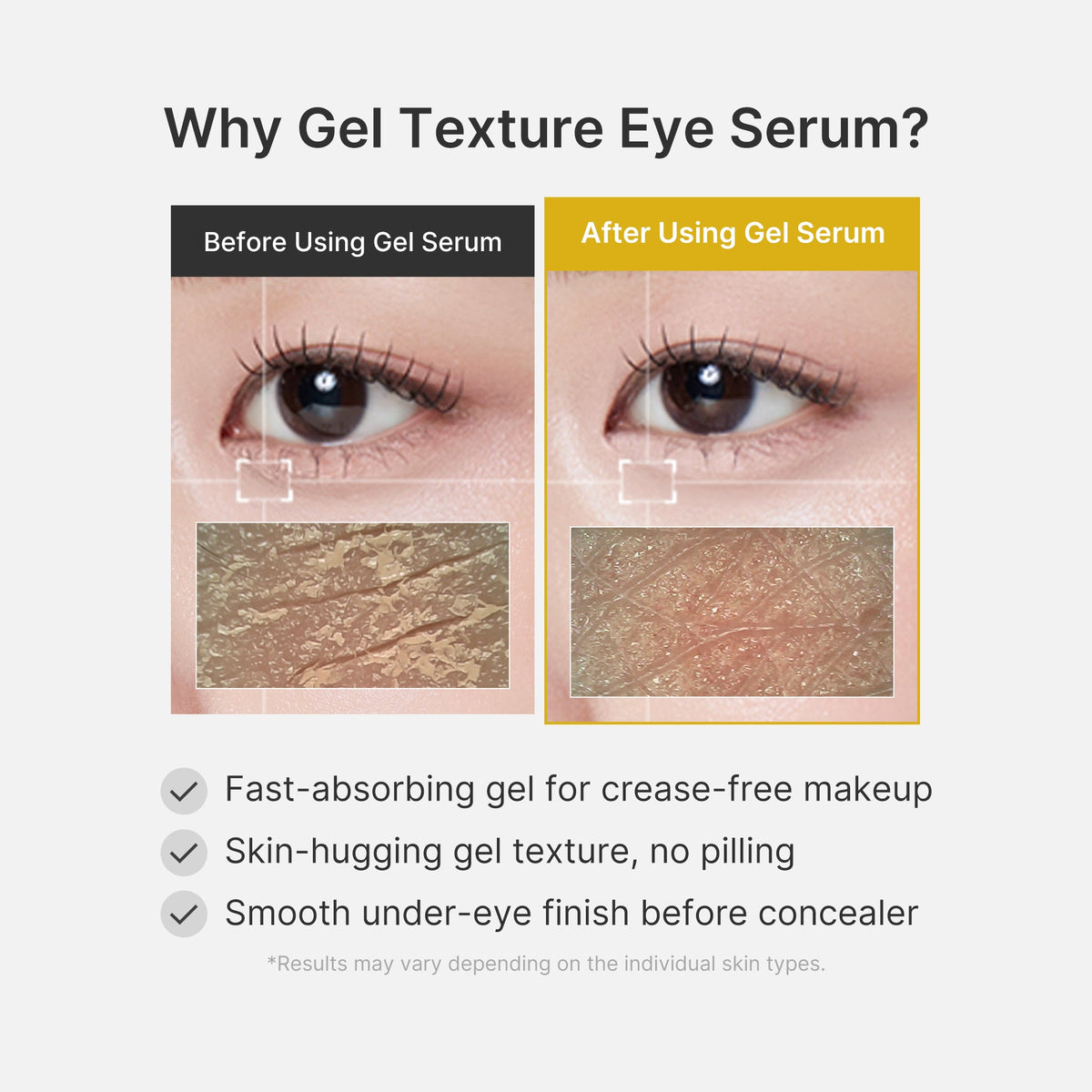 Kojic Acid Tumeric Eye Gel Serum K7