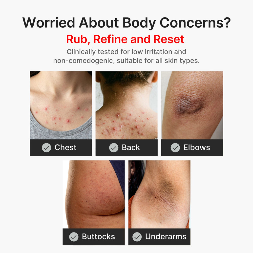 Kojic Acid Turmeric Body Peel Shot A0