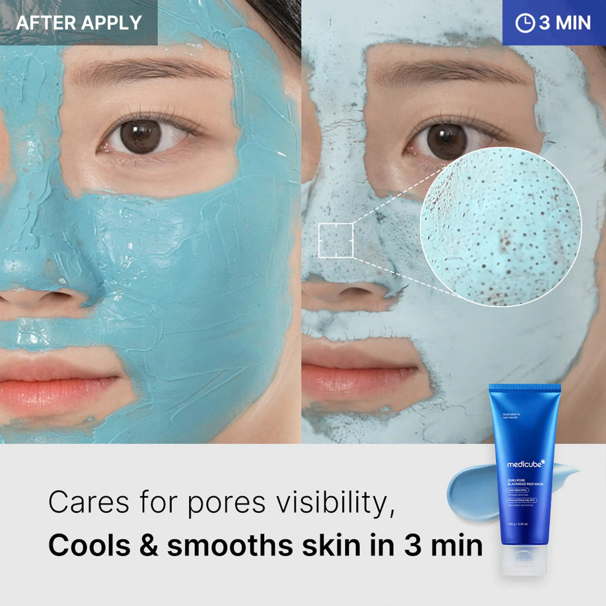 Zero Pore Blackhead Mud Mask H8