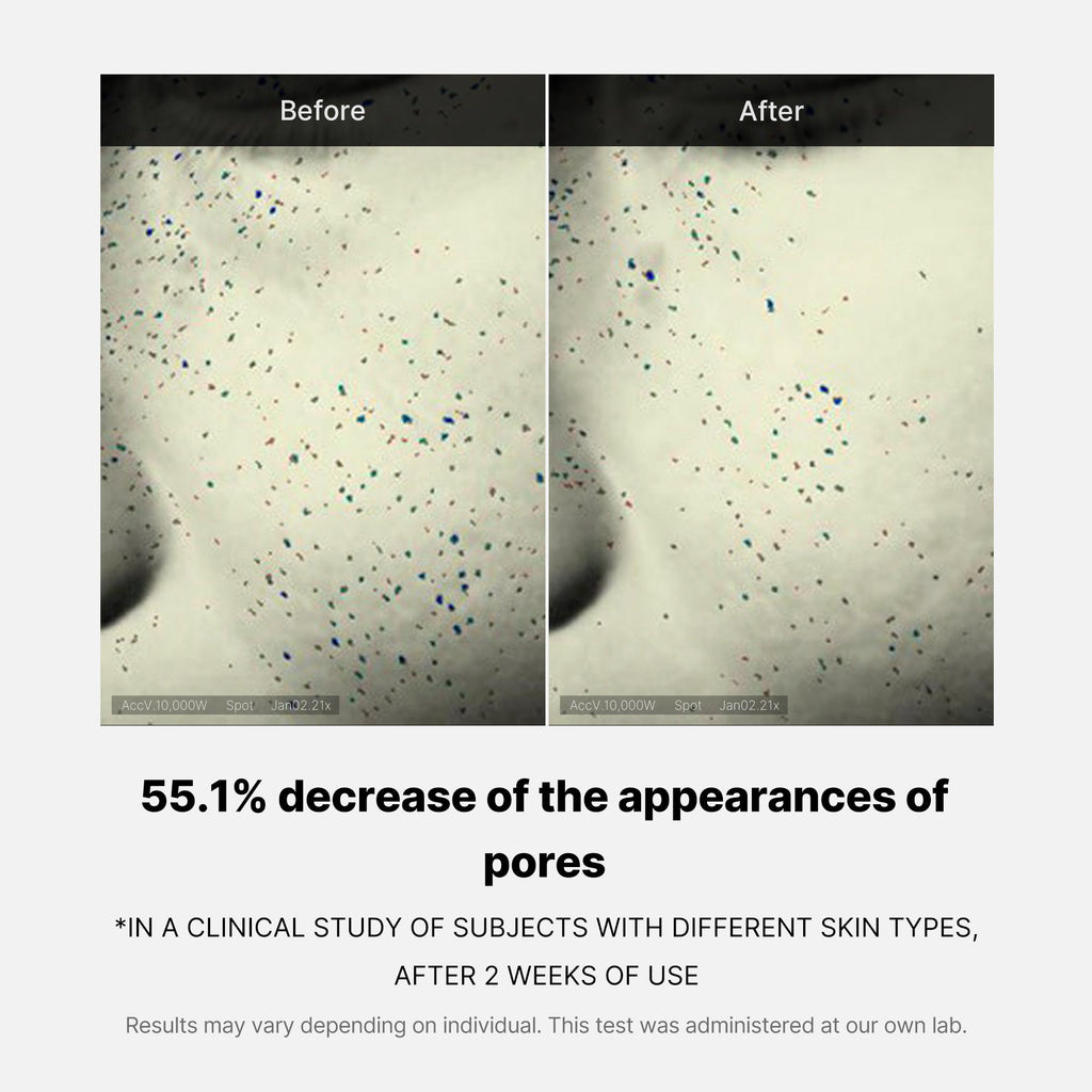 Pore Care Duo X9