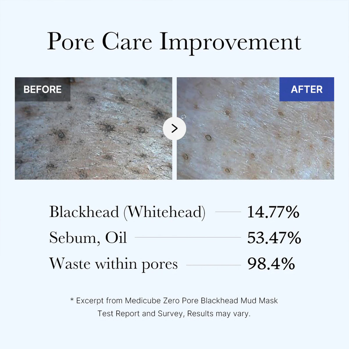 Zero Pore Blackhead Mud Mask H8