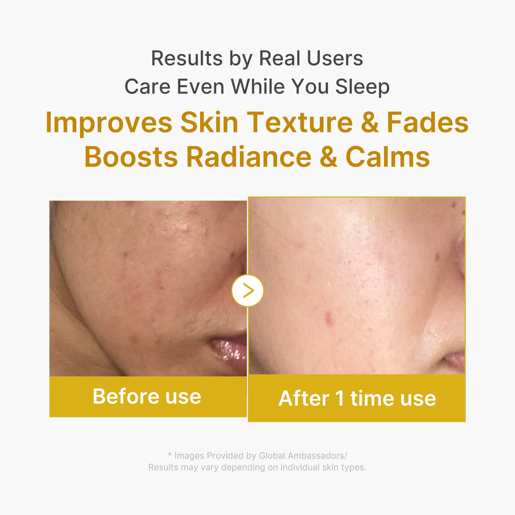 Kojic Acid Turmeric Overnight Wrapping Mask R4