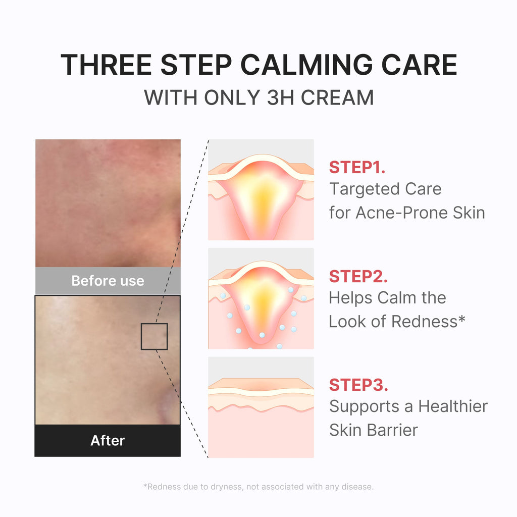 3H Daily Relief Cream A1
