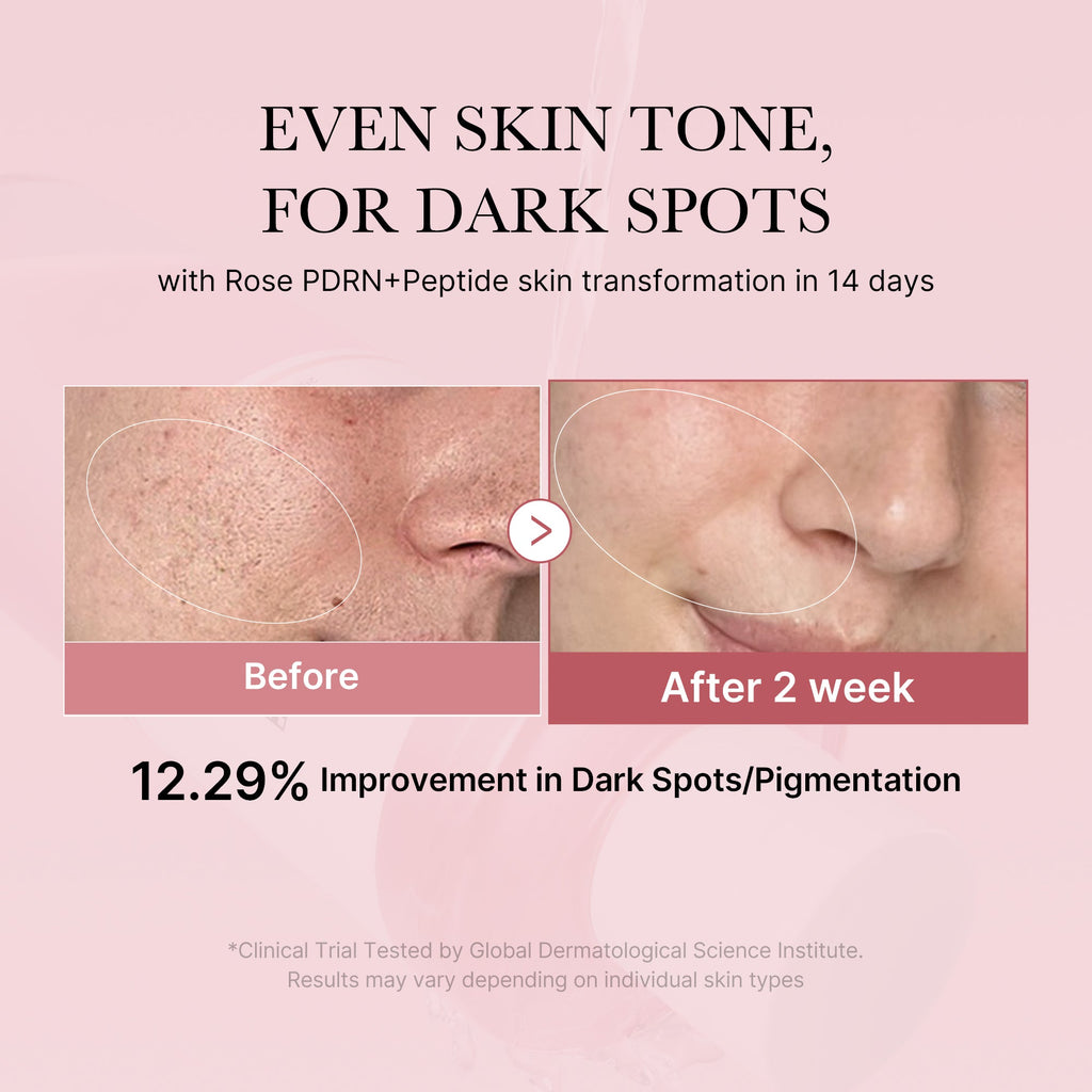 PDRN Pink Peptide Toner R1