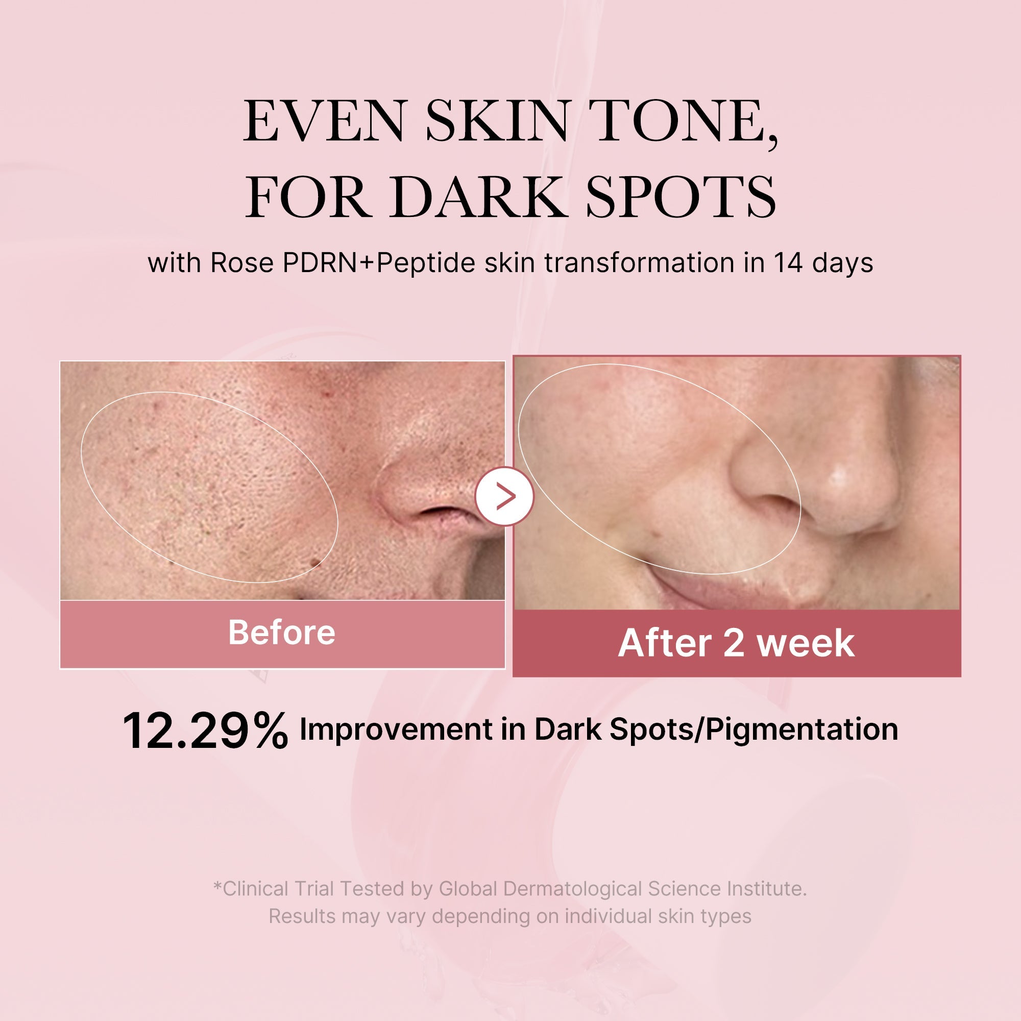 PDRN Pink Peptide Toner R1