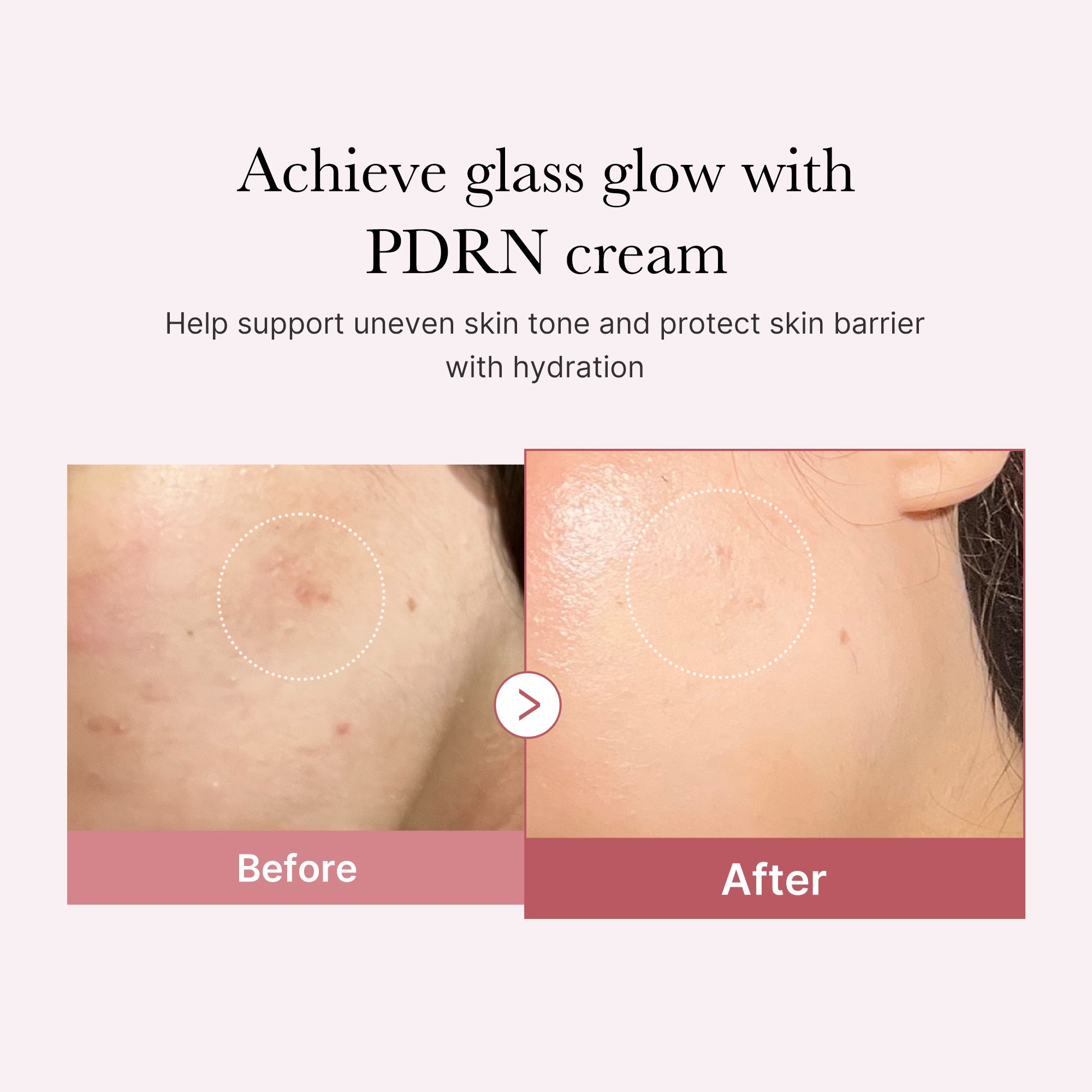 PDRN Pink Peptide Cream Z9