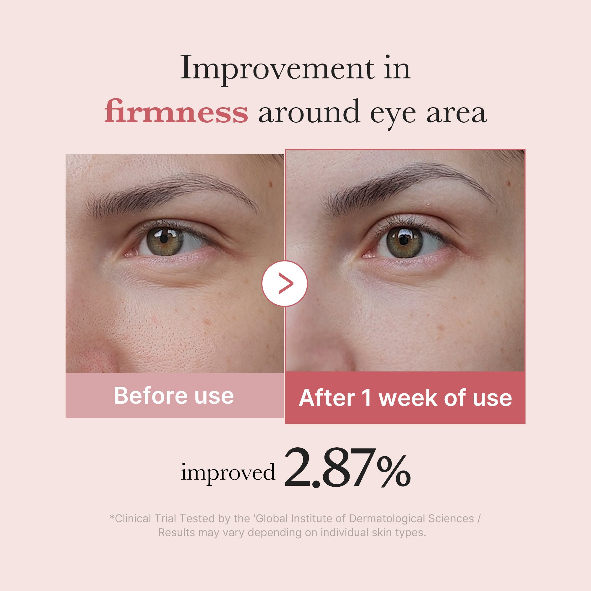 PDRN Pink Peptide Eye Cream N0