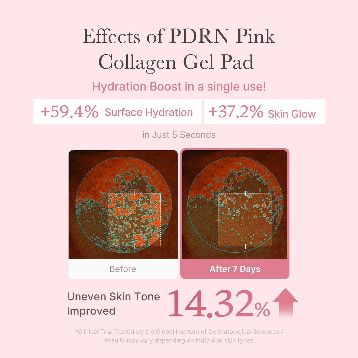 PDRN Pink Collagen Gel Toner Pad Z7