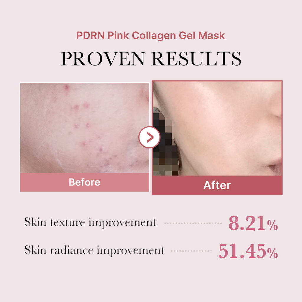 Salmon PDRN Pink Collagen Jelly Gel Mask U7