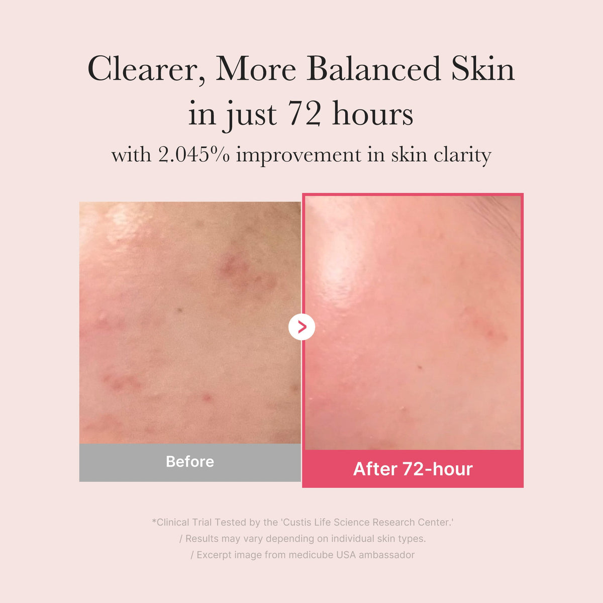 TXA Niacinamide Serum F3
