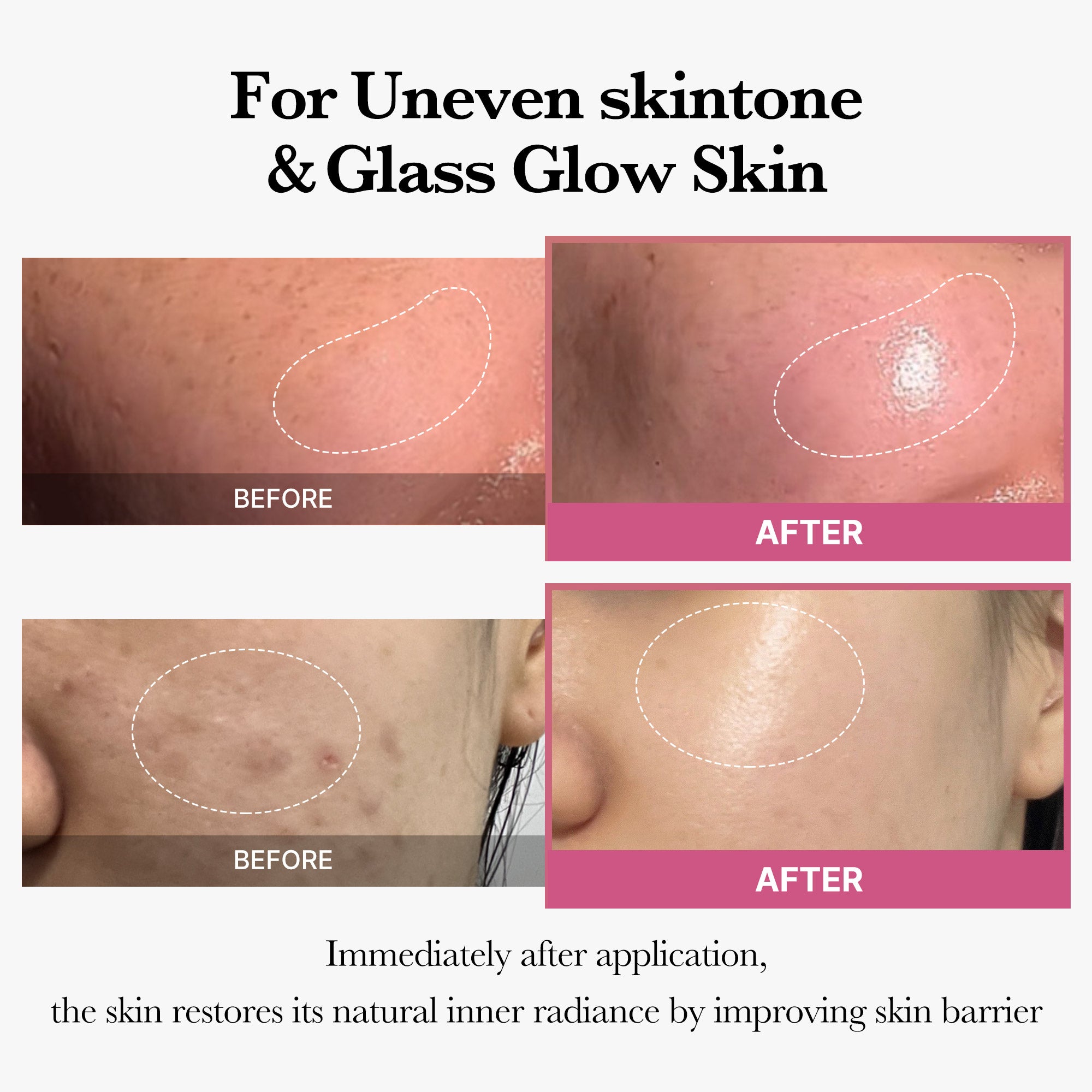 [Tati's Exclusive] All About Glow Set W9
